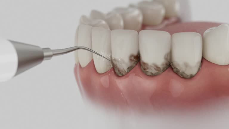 Reliable Dental Implants contractor in Morgantown, IN by Smile Center Dentistry